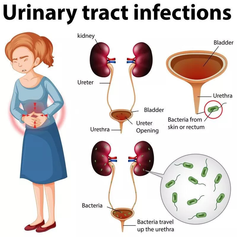 4 x UTI URINE/URINARY TRACT INFECTION CYSTITIS/BLADDER TESTS (1 TEST PER FOIL)